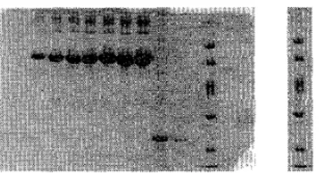 Figure  1:  (a)  Denaturing PAGE  image, (b)  a  lane  of  the denaturing PAGE image 