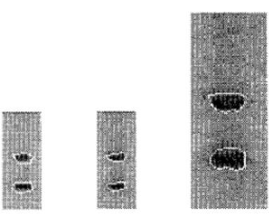 Figure  5:  Prot,ein of  interest  is  enclosed  within  the  snake  :  (a) Initial position of  the snake located on the  extracted  edge  (b) The snake in  (a) after one  iteration  on  low-resolution  image  (c)  Snake obtained  using  the  inultiresolu