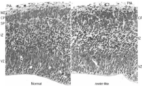 Figure 1.8 Histological appearance of the normal and reeler telencephalon. 
