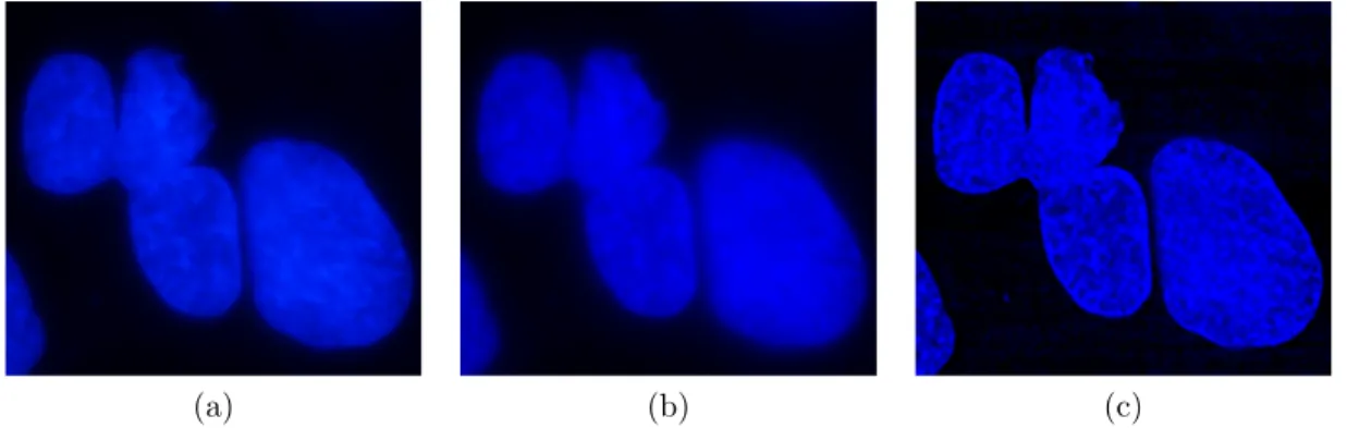 Figure 3.5: DAPI stained cell nuclei image (100X) from Huh7 cells obtained with best possible focus: x f and (b) another image with slight out of focus x g 