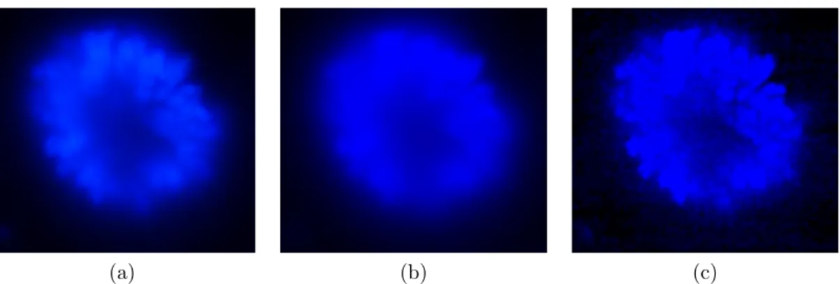 Figure 3.6: The Huh7 cells nucleus image (100x) obtained with best possible focus: x f and (b) another image with slight out of focus x g 