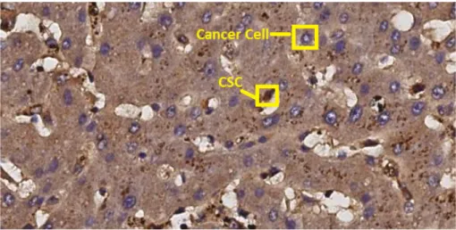 Figure 3.1: A liver cancer tissue stained using CD13 primary antibodies.