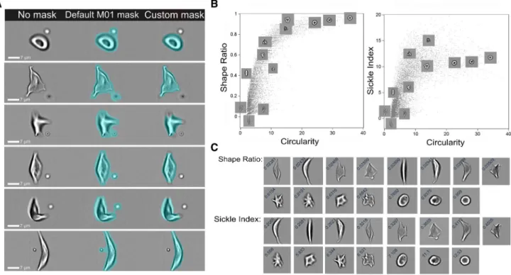 Figure 2. Masking and gating strategy to identify normal, intermediate, and sickle cell region boundaries in deoxygenated SS-RBCs.