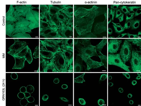Figure 3. Western blot analysis of E-cadherin expression in GRN163L- (1 µM)  and mismatch (MM) oligonucleotide (1 µM)-treated A549 cells