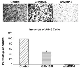 Figure 6. Analysis of cyclin D1, Cdk6 and Cdk4 mRNA expression in untreated,  mismatch (MM) oligonucleotide- and GRN163L-treated cells by real-time  RT-PCR (n=3).