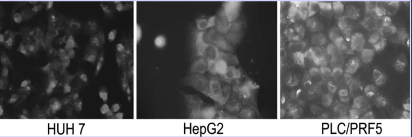 FIG. 5. Secreted forms of 6D5 target proteins. Protein secre- secre-tion was evaluated in isogenic cell lines Hep3B and  Hep3B-TR