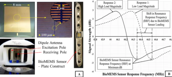 Figure 1. (A) Macro and micro digital images of the bioMEMS sensor, digital image of dipole antenna placed over the bioMEMS sensor; digital image of the BioMEMS sensor—locking plate construct