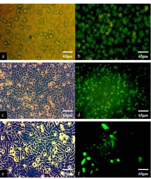 Fig. 3. Representative micrographs showing polymer and DNA uptake, and gene expression of HeLa cells in cell cultures: (a) Light microscopy image of poly(NIPA)/PEI25L uptake; (b) fluorescence microscopy image of poly(NIPA)/PEI25L uptake; (c) light microsco