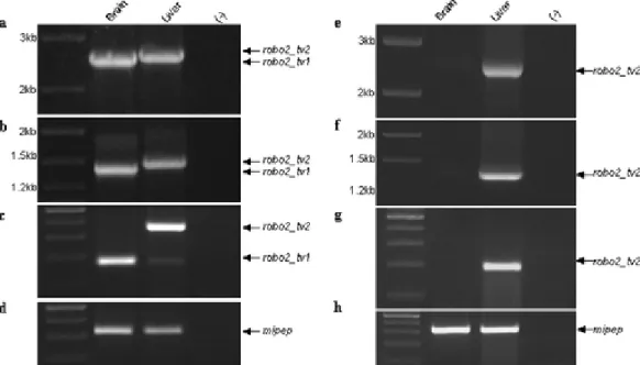 Figure 4.5. The expression of robo2_tv1 and robo2_tv2 isoforms on zebrafish brain and  liver tissues