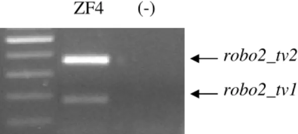 Figure  4.7.  The  expression  of  robo2  isoforms  in  ZF4.  RT-PCR  result  with  the  primer  pair  E21F–E22R  (expected  amplicon  sizes  172  and  358,  with  and  without  CAE,  respectively)  performed  on  a  cDNA  for  ZF4  grown  under  normal  c