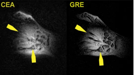 Figure 8.  Coronal slice from the 3D CEA MR image of the healthy volunteer wrist (left), and GRE image as the  anatomical reference (right).