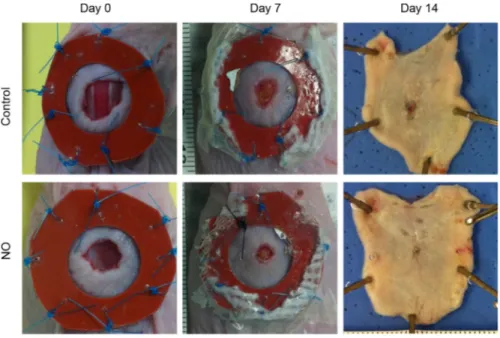 Fig. 6.3 Weekly administration of NO-releasing dressings improves wound closure.