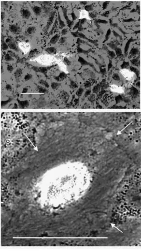 Fig. 9. pcDNA3-HC1D-EGFP transfection of cells (Huh7) with non- non-functional p53. Transiently transfected Huh7 cells are growing normally and they form a monolayer at about 48 hours  post-transfection (upper image, overview)