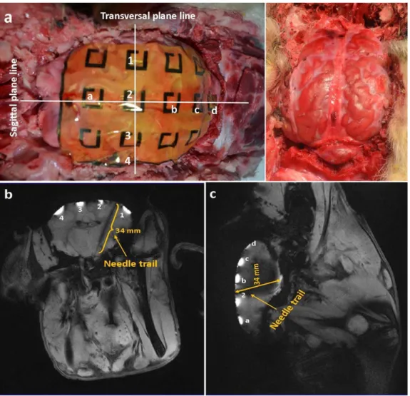 FIG. 8. Anatomic tissue localization using our passive RF-resonator markers placed over the human head (a) and the human knee (b).