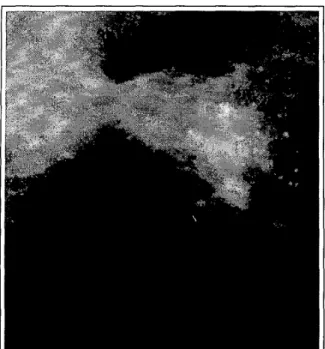 Figure  2:  Detection  scheme output.  Regions with  mi-  crocalcifications are indicated  by the detection  scheme