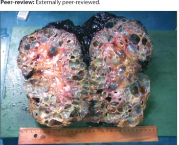 Figure 1. Macroscopic view of the specimen Figure 2. Macroscopic view of a section of the specimen