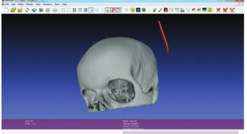 Figure 3: Removing of floating substances not attached to the anatomic model in MeshLab.