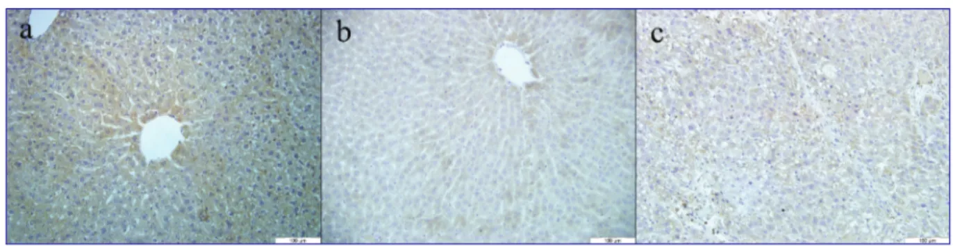 Fig 4. PPAR-α immunohistochemistry; a) Control: Strong immunoreactivity, b) CCl 4 : Very weak immunoreactivity, c) CCl 4  + Omega: Weak  to moderate immunoreactivity