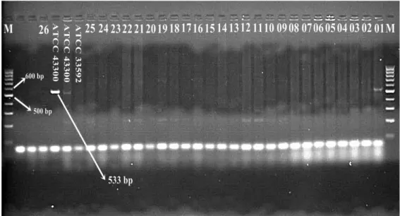 ġekil 4.5. mecA geni için tüm izolatlara yapılan PCR görüntüsü. (M: Marker,    
