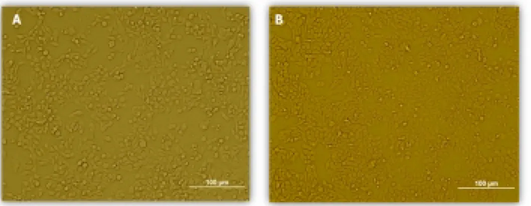 Şekil 3.3  En yüksek TNFα konsantrasyonuna maruz kalmış HT-29 hücrelerinin      24 saat sonundaki morfolojik görüntüsü (A:Kontrol, B:1000U)