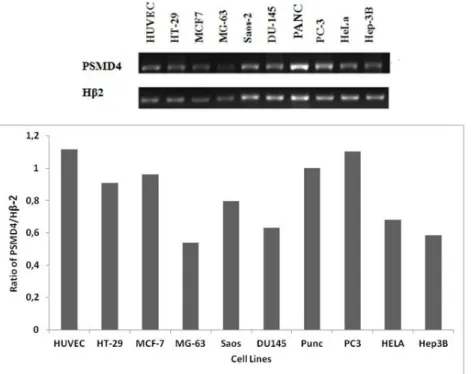 Figure 1: Analysis of mRNA level of PSMD4 gene in different cell lines. Products were obtained with RT-PCR and run on  agarose gel