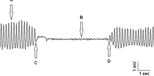 Figure 2. A sample of systolic blood pressure record from a rat from heated and freely moving group