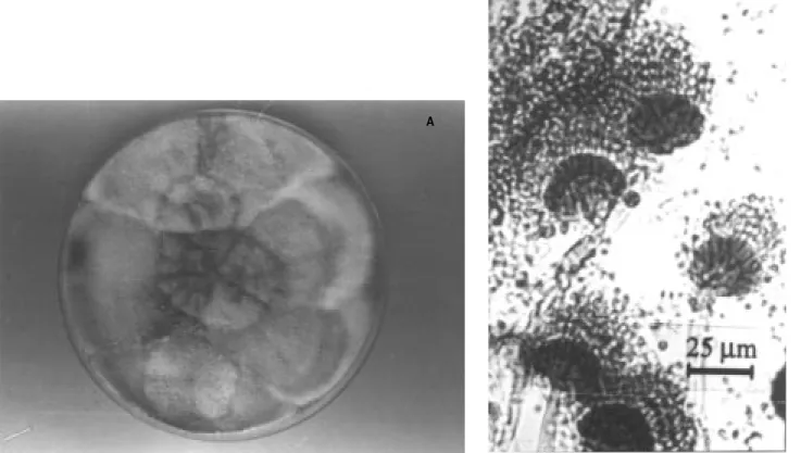 Figure 9. A. viridinutans on MEA (A), microscopic appearance of conidial head (B).
