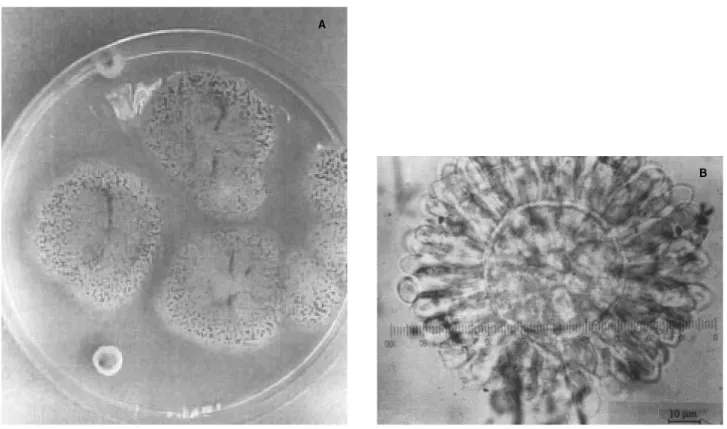 Figure 2. A. flavofurcatus on MEA (A), microscopic appearance of conidial head (B). 