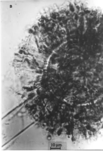 Figure 3. A. foetidus var. acidus. on MEA (A), microscopic appearance of conidial head (B) and phialide (C).