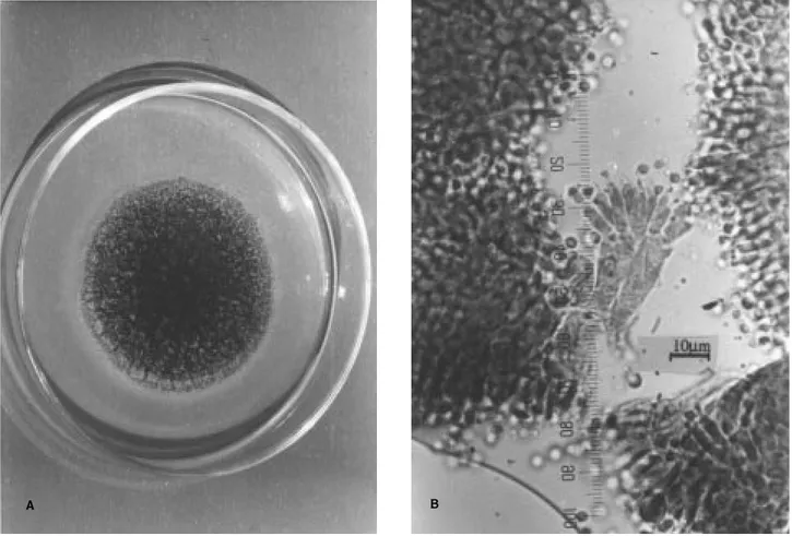 Figure 4. A. foetidus var. pallidus on CZ (A), microscopic appearance of phialide and conidia (B).