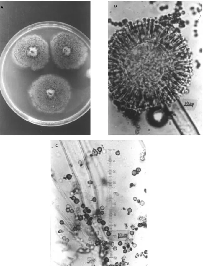 Figure 5. A. heteromorphus on CZ (A), microscopic appearance of conidial head (B) and conidia (C).