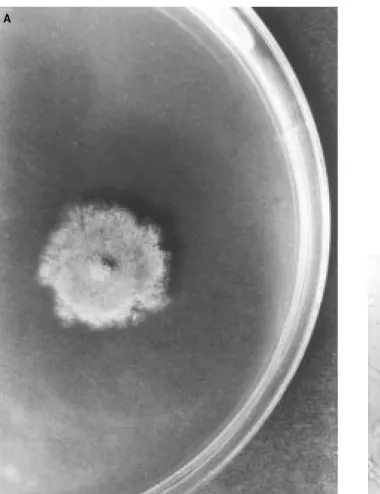 Figure 8. A. unguis on CZ (A), microscopic appearance of conidial head (B) and sterile hyphae (C).