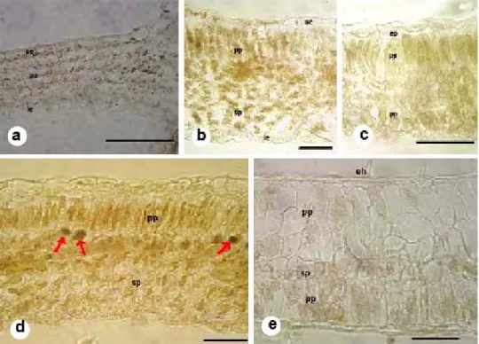 Fig. 2. Comparative mesophyll tissue of Hyoscyamus species. a. H. pusillus, b. H. niger, c