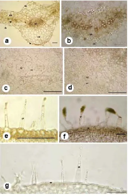 Fig. 3. General anatomical structures of Hyoscyamus species. a-b. Middle vascular tissue  observed on  Hyoscyamus leaves ( a