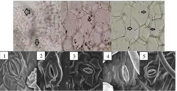 Şekil 4. Taksonların stoma yüzeysel ve kristal (oklar çeşitli tipte kristalleri göstermektedir) görüntüleri
