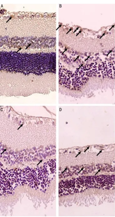 Figure 2 Representative photomicrographs of retinal immunostaining for TUNEL in different groups A: In a normal control group; B: In Sham group TUNEL-positive cells (arrows) were increased in retinal layers; C: Pre- treatment selenium groups showed lower T