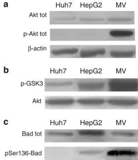 Fig. 1 Akt activity analysis in HCC cell lines. a Western blot analysis of untreated Huh7, HepG2, and Mahlavu cell lines, detected with anti Akt antibody or anti-p-Akt antibody