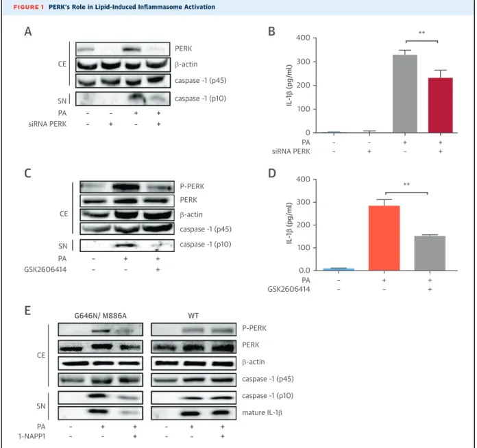 FIGURE 1 PERK’s Role in Lipid-Induced Inﬂammasome Activation