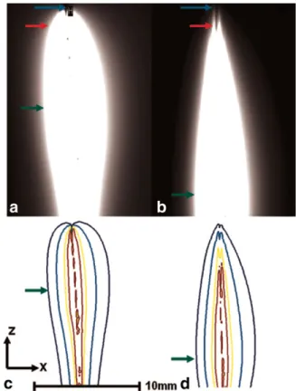 Figure 6 shows axial images of the pig aorta specimen acquired 1 cm proximal to the tip of the uniform- and