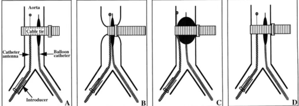 Figure  1.  Illustration of  the experimental design for intravascular MR-monitored  balloon  angioplasty on a rabbit