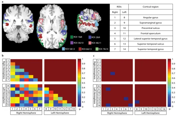 Figure 1: Brain regions of interest demonstrated in one subject (a), One-way ANOVA results of pairwise correlations (b)