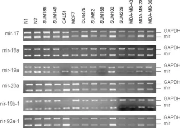 Fig. 4. Duplex RT-PCR for hsa-mir-383 and GAPDH. 1. MCF7, 2. MDA- MDA-MB-231, 3. HeLa, 4