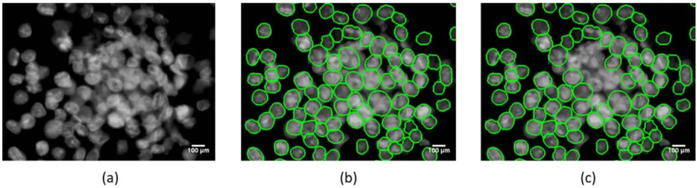 Figure 15. Visual segmentation results obtained when the tight nucleus cluster detection method is used