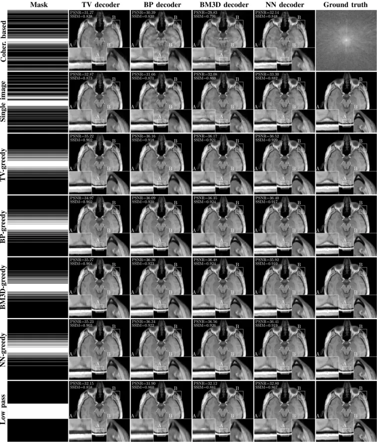 Fig. 2. MRI reconstruction example for the test subject 2, slice 4 at 25% subsampling rate