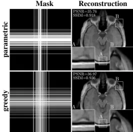 Fig. 3. Masks obtained and example reconstructions under TV decoding at 25% sampling rate, for the parametric method of [35] combined with Algorithm 2, and the greedy method given in Algorithm 1