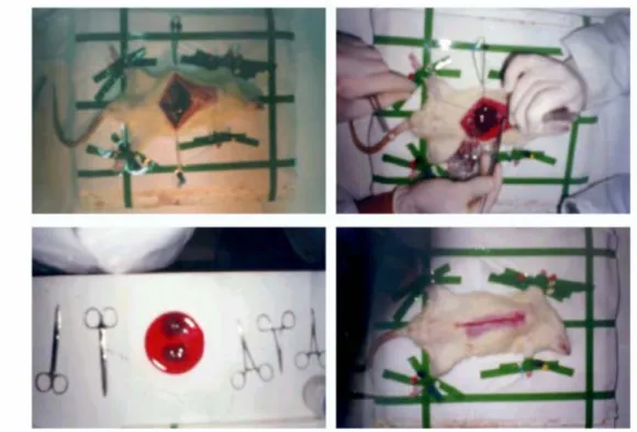 Figure 3.1. The steps of the liver resection surgery for partial hepatectomy (PH)  