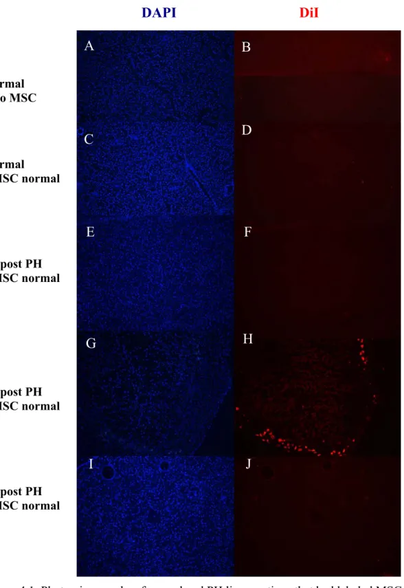 Figure 4.1. Photomicrographs of normal and PH liver sections that had labeled MSC  generated from normal rat (Magnification: 20X)