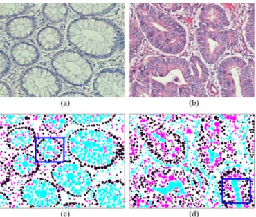 Fig. 1. Examples of (a) normal and (b) cancerous tissue images. Objects located on the (c) normal and (d) cancerous tissue images