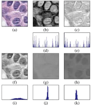 Fig. 3. (a) Original 120 × 120 pixel patch, (b) deconvolved color channel that shows good contrast for nuclei dyed with haematoxylin, (c) deconvolved color channel that shows good contrast for eosin dye, (d) LBP histogram calculated on haematoxylin channel