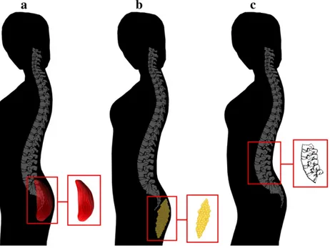 Fig. 4. Buttock protrusion associated with (a) gluteal development indicating physical ﬁtness, (b) adipose tissue deposition, and (c) vertebral wedging